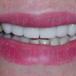 Judy H. Oh, D.D.S. General & Cosmetic Dentistry